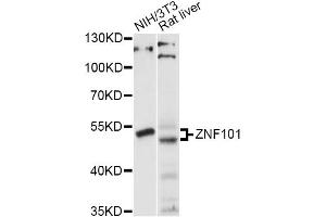 Western blot analysis of extracts of various cell lines, using ZNF101 antibody (ABIN6293896) at 1:1000 dilution. (ZNF101 anticorps)