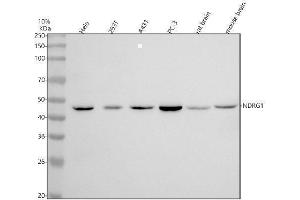 Western blot analysis of NDRG1 using anti-NDRG1 antibody (ABIN7605671).