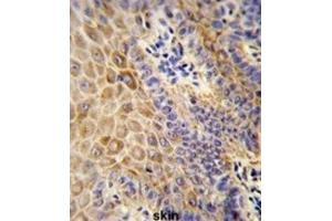 Immunohistochemistry (IHC) image for anti-Glucosylceramidase (GLCM) antibody (ABIN3003972) (Glucosylceramidase anticorps)