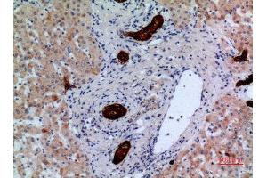 Immunohistochemistry (IHC) analysis of paraffin-embedded Human Liver, antibody was diluted at 1:100.
