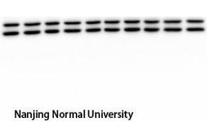 Western Blot (WB) analysis: Please contact us for more details. (ERK1/2 anticorps  (pTyr204))