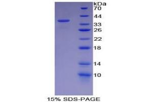 SDS-PAGE analysis of Mouse Neurofibromin 2 Protein. (Merlin Protéine)