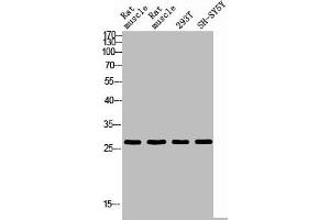 Western blot analysis of RAT-MUSLE RAT-SPLEEN 293T SH-SY5Y using IL26 antibody. (IL-26 anticorps  (Internal Region))