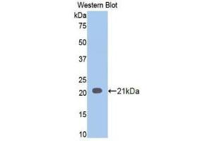 Western Blotting (WB) image for anti-Involucrin (IVL) (AA 6-156) antibody (ABIN1859461) (Involucrin anticorps  (AA 6-156))