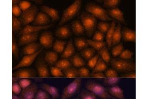 Immunofluorescence analysis of HeLa cells using DDX31 Polyclonal Antibody at dilution of 1:100.