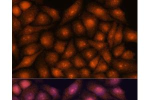 Immunofluorescence analysis of HeLa cells using DDX31 Polyclonal Antibody at dilution of 1:100. (DDX31 anticorps)