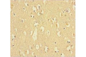 Immunohistochemistry of paraffin-embedded human brain tissue using ABIN7154647 at dilution of 1:100 (C9ORF72 anticorps  (AA 138-430))