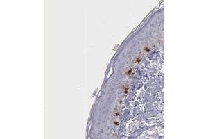 Immunohistochemical staining (Formalin-fixed paraffin-embedded sections) of human skin shows distinct cytoplasmic positivity in melanocytes with TYRP1 polyclonal antibody . (Tyrosinase-Related Protein 1 anticorps  (AA 257-377))