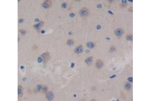 Used in DAB staining on fromalin fixed paraffin- embedded brain tissue