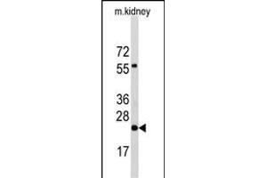 Western blot analysis of anti-PEMT Antibody (N-term) Pab (ABIN650614 and ABIN2844055) in mouse kidney tissue lysates (35 μg/lane). (PEMT anticorps  (N-Term))