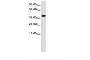 Image no. 1 for anti-Heat Shock 70kDa Protein 1A (HSPA1A) (AA 286-335) antibody (ABIN202621) (HSP70 1A anticorps  (AA 286-335))