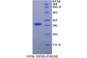 SDS-PAGE analysis of Mouse PK Protein. (PKLR Protéine)