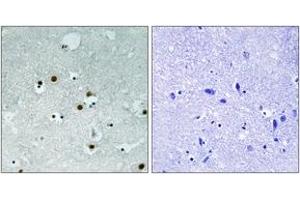 Immunohistochemistry analysis of paraffin-embedded human brain tissue, using HP1 alpha (Ab-92) Antibody.