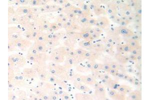 IHC-P analysis of Human Liver Tissue, with DAB staining. (Cathepsin K anticorps  (AA 54-317))