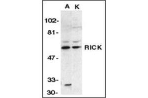 Western blot analysis of RICK in A431 (A) and K562 (K) whole cell lysate with this product at 1:1000 dilution. (RIPK2 anticorps  (N-Term))