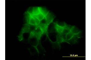 Immunofluorescence of monoclonal antibody to PCDH1 on A-431 cell. (Protocadherin 1 anticorps  (AA 62-169))
