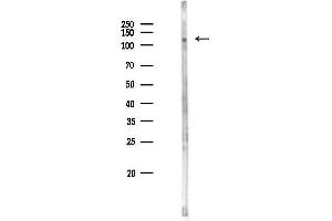 Western blot analysis of lysates from COLO205 cells(heat-shock 45 min treatment), using PRDM10 Antibody at 1/1000 dilution.