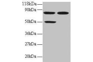 Western blot All lanes: CCL22 antibody at 2 μg/mL Lane 1: 293T whole cell lysate Lane 2: EC109 whole cell lysate Secondary Goat polyclonal to rabbit IgG at 1/15000 dilution Predicted band size: 11 kDa Observed band size: 50, 80 kDa