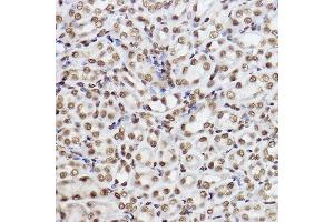 Immunohistochemistry of paraffin-embedded mouse kidney using UBE2B Rabbit mAb (ABIN7271173) at dilution of 1:100 (40x lens).