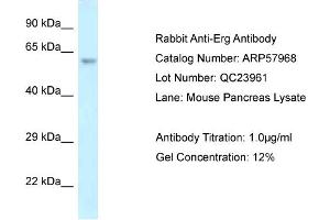 Western Blotting (WB) image for anti-ERG, ETS transcription factor (ERG) (C-Term) antibody (ABIN2787486) (ERG anticorps  (C-Term))