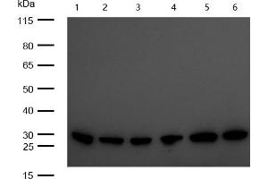 All lanes : C1QBP Rabbit mAb at 1/1k dilution Lane 1 : 3T3 whole cell lysates Lane 2 : Mouse Brain lysates Lane 3 : Mouse Kidney lysates Lane 4 : C6 whole cell lysates Lane 5 : Rat Brain lysates Lane 6 : Rat Kidney lysates Lysates/proteins at 20 μg per lane.