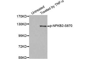 Western Blotting (WB) image for anti-Nuclear Factor of kappa Light Polypeptide Gene Enhancer in B-Cells 2 (NFKB2) (pSer870) antibody (ABIN1870475) (NFKB2 anticorps  (pSer870))