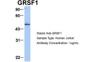 Host:  Rabbit  Target Name:  GRSF1  Sample Type:  Jurkat  Antibody Dilution:  1. (GRSF1 anticorps  (Middle Region))