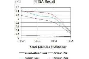 Black line: Control Antigen (100 ng),Purple line: Antigen (10 ng), Blue line: Antigen (50 ng), Red line:Antigen (100 ng)