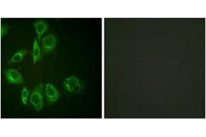 Immunofluorescence analysis of HuvEc cells, using PKC-pan (Ab-Thr497) Antibody. (PKC anticorps  (Thr497))