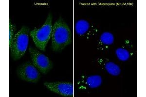 Fluorescent image of U251 cells stained with anti-ATG5 antibody diluted at 1:25 dilution.