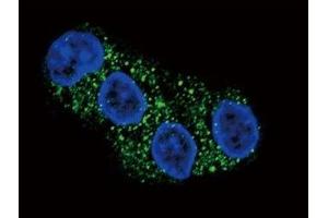 Confocal immunofluorescent analysis of ABCG2 antibody with HepG2 cells followed by Alexa Fluor 488-conjugated goat anti-rabbit lgG (green).