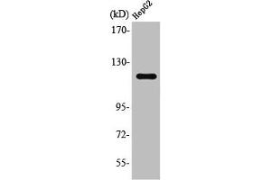 Western Blot analysis of Jurkat cells using SPT16 Polyclonal Antibody (SUPT16H anticorps  (C-Term))