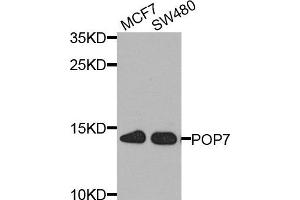 Western blot analysis of extract of MCF7 and SW480 cells, using POP7 antibody. (POP7 anticorps)