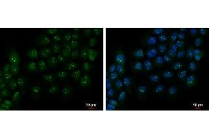 ICC/IF Image PAF49 antibody detects PAF49 protein at nucleolus by immunofluorescent analysis. (CD3EAP anticorps  (Center))
