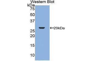 Western blot analysis of the recombinant protein. (Merlin anticorps  (AA 30-239))