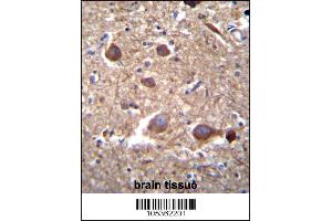 ITPKB Antibody immunohistochemistry analysis in formalin fixed and paraffin embedded human brain tissue followed by peroxidase conjugation of the secondary antibody and DAB staining.