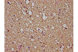IHC image of ABIN7153853 diluted at 1:200 and staining in paraffin-embedded human brain tissue performed on a Leica BondTM system.