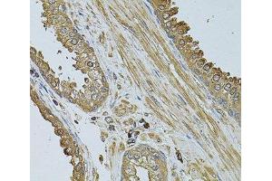 Immunohistochemistry of paraffin-embedded Human prostate using MYLIP Polyclonal Antibody at dilution of 1:100 (40x lens). (MYLIP anticorps)