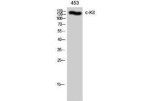 Western Blotting (WB) image for anti-Mast/stem Cell Growth Factor Receptor (KIT) (Ser71) antibody (ABIN3183926) (KIT anticorps  (Ser71))