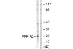 Western blot analysis of extracts from Jurkat cells, using PPP1R2 (Ab-120/121) Antibody.