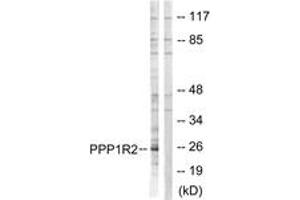 Western blot analysis of extracts from Jurkat cells, using PPP1R2 (Ab-120/121) Antibody. (PPP1R2 anticorps  (AA 86-135))