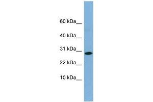 WB Suggested Anti-RPE Antibody Titration: 0.