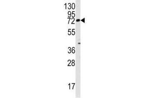 Western blot analysis of Rex1 antibody and mouse lung tissue lysate