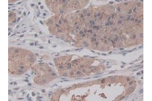 Detection of RALA in Human Stomach Tissue using Monoclonal Antibody to V-Ral Simian Leukemia Viral Oncogene Homolog A (RALA) (rala anticorps  (AA 1-206))