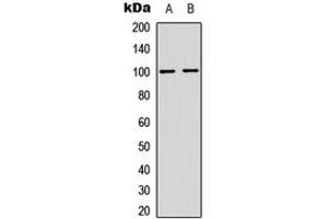 Western blot analysis of NF-kappaB p100 (pS865) expression in HeLa (A), MCF7 (B) whole cell lysates. (NFKB2 anticorps  (C-Term, pSer865))