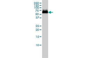 GBA monoclonal antibody (M01), clone 2E2 Western Blot analysis of GBA expression in MCF-7 .