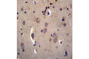 Formalin fixed and paraffin embedded human brain tissue stained with DTNA / DRP3 Antibody (C-term) followed by peroxidase conjugation of the secondary antibody and DAB staining.