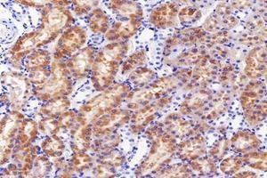 Immunohistochemistry analysis of paraffin-embedded mouse kidney using,DAK (ABIN7073737) at dilution of 1: 5000 (DAK anticorps)