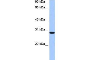 WB Suggested Anti-RALYL Antibody Titration:  0.