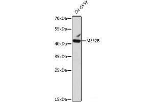 Western blot analysis of extracts of SH-SY5Y cells using MEF2B Polyclonal Antibody at dilution of 1:1000. (MEF2B anticorps)